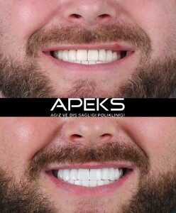 Image of Apeks Dental Clinic - Antalya Gallery 1