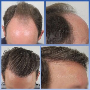 Image of Essi Hair Transplant Clinic Gallery 2