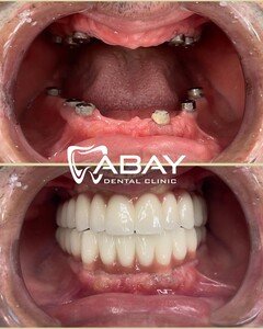 Image of Abay Dental Centre Gallery 1