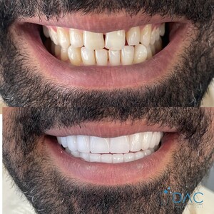 Image of DAC - Alanya Dental Aesthetic Clinic Gallery 0