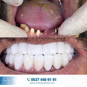 Image of Antasya Dental Gallery 0