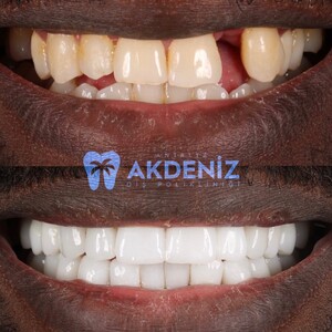 Image of Antalya Akdeniz Dental Clinic Gallery 0