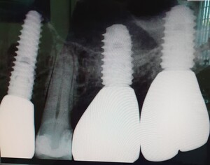 Image of Dental X-Ray