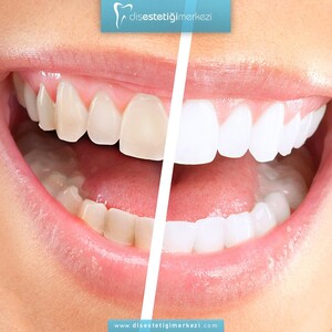 Image of Dental Aesthetics Center Gallery 0