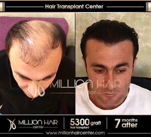 Image of Million Hair Clinic Gallery 2