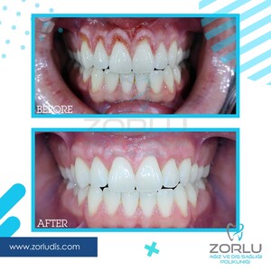 Image of Zorlu Oral and Dental Health Center Gallery 1