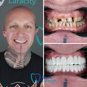 Image of Dent Laracity Dental Clinic Gallery 0