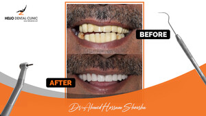 Image of Smile Makeover - Helio dental clinics