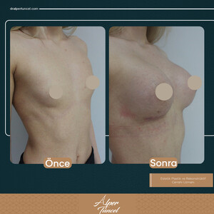 Image of Dr.Alper Tuncel Aesthetic Clinic Gallery 3