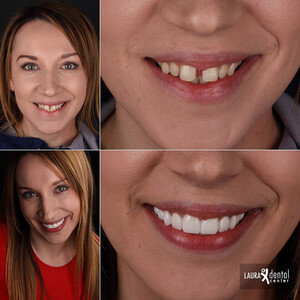 Image of Laura Dental Center Turkey Gallery 2