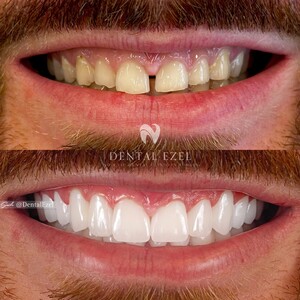 Image of Dental treatments