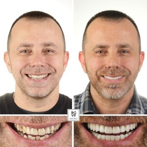 Image of Dentes Dental Clinic Gallery 0