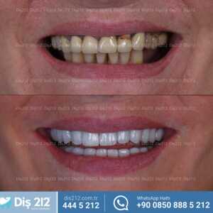 Image of Diş 212 - Dental Aesthetic Facility Gallery 3