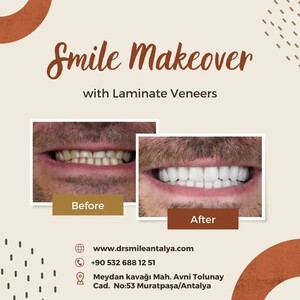 Image of Dr. Smile Antalya Gallery 2