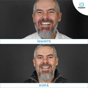 Image of Smile makeover - Dent Park