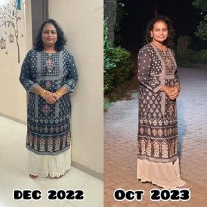 Image of Bariatric surgery before and after