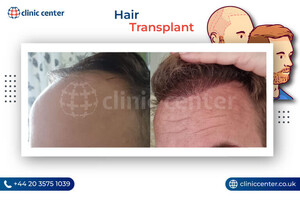 Image of Clinic Center - Hair Transplant Clinic Turkey Gallery 1