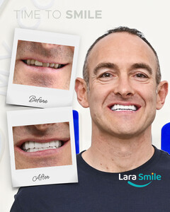 Image of Lara Smile Gallery 3