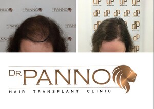 Image of Dr. Panno Hair Clinic Gallery 0