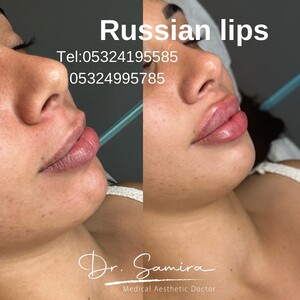 Image of Dr. Samira Hajiyeva - Dr. EstheticS, Health and Beauty Center Gallery 0