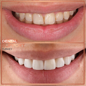 Image of Dental Support Turkey Gallery 0