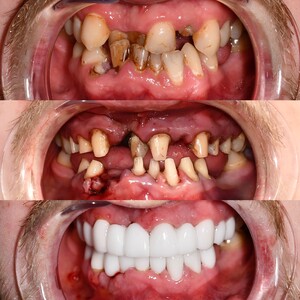 Image of Demet Dental Clinic Gallery 3