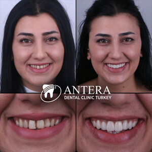 Image of Antera Dental Clinic Turkey Gallery 1