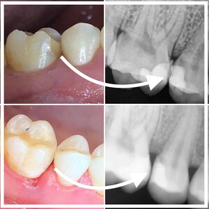 Image of Dental X-Ray- Amadenta