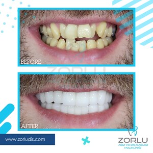 Image of Zorlu Oral and Dental Health Center Gallery 0