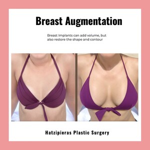 Image of Hatzipieras Plastic Surgery Gallery 0