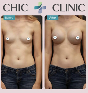 Image of Chic Clinic Istanbul Gallery 0