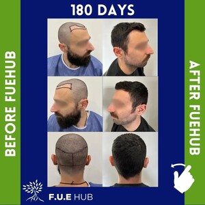 Image of Fuehub Hair Restoration Gallery 2