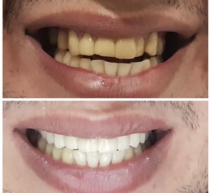 Image of Dental Care Before and After