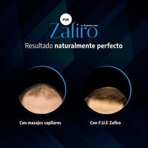 Image of Medical Hair Spain Gallery 0