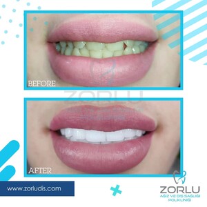 Image of Zorlu Oral and Dental Health Center Gallery 3