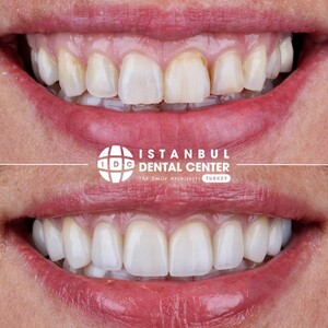 Image of Istanbul Dental Center Gallery 0