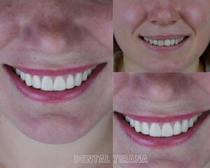 Image of Dental Tirana Gallery 1