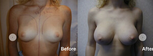 Image of Linia Cosmetic Surgery Gallery 2