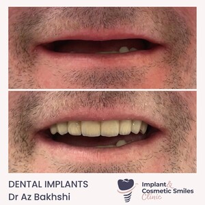 Image of The Implant and Cosmetic Smiles Clinic Gallery 2