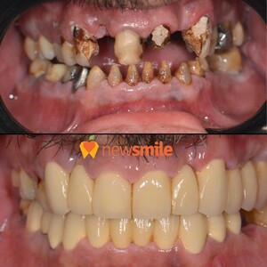 Image of New Smile Dental Clinic Gallery 2