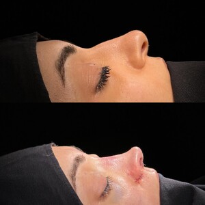 Image of Umman Tunç - Rhinoplasty Clinic Gallery 0