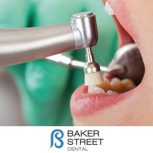 Image of Baker Street Dental Gallery 0