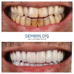 Image of SembolDiş Oral an Dental Health Polyclinic Gallery 1