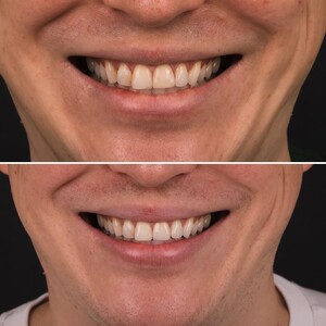 Image of Aesthetic dentistry before and after