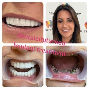 Image of Dental City Turkey Gallery 1