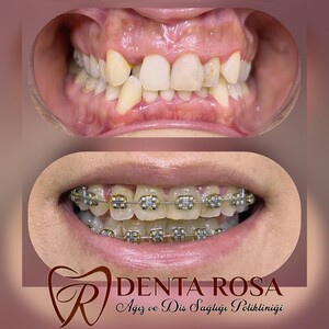 Image of Denta Rosa Oral and Dental Health Polyclinic Gallery 2