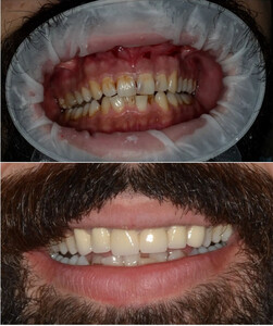 Image of New Smile Antalya Dental Clinic Gallery 2