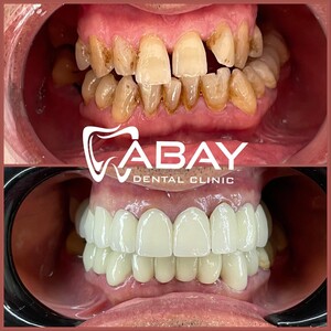 Image of Abay Dental Centre Gallery 2