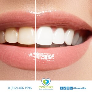 Image of Evrensel Oral and Dental Health Clinic Gallery 1