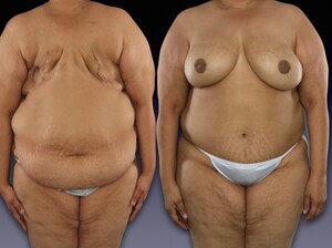 Image of Center for Restorative Breast Surgery Gallery 1